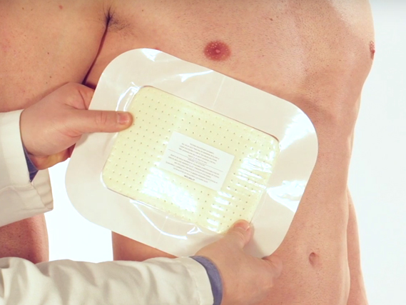 Chrisofix® Fracture Costale presentation, confort, sécurité et réduction des douleurs pour les côtes cassées